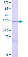 12.5% SDS-PAGE Stained with Coomassie Blue.